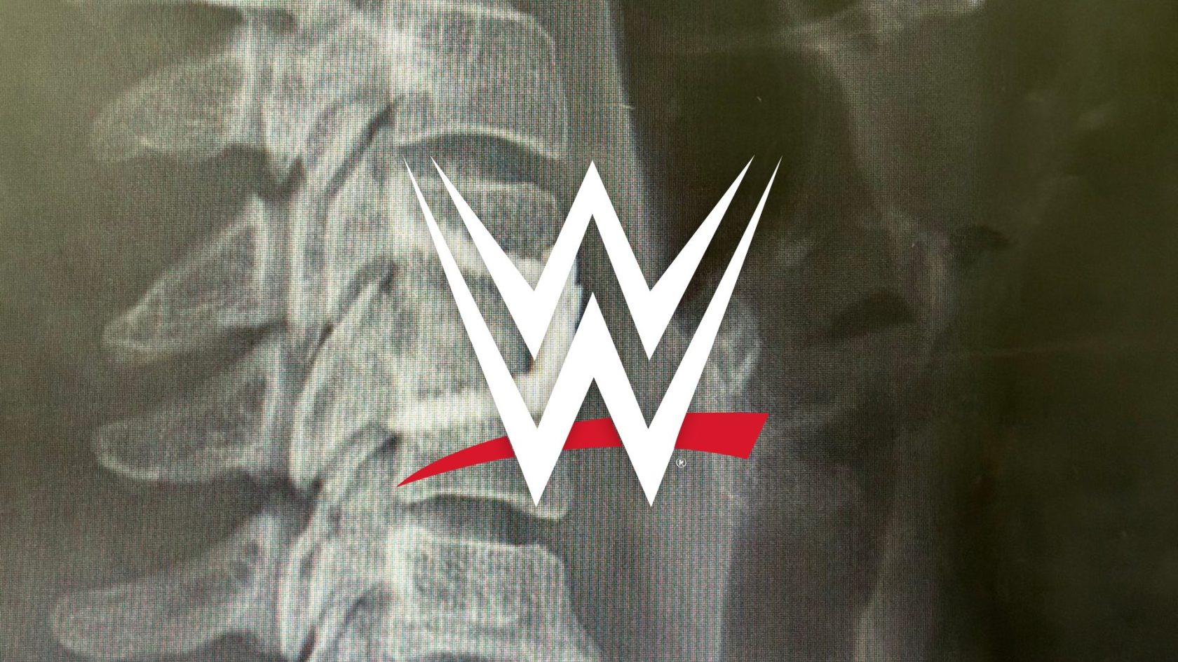 WWE Star Issues Positive Update And X-Ray On Career-Threatening Neck Injury
